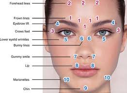 Printable Botox Face Chart Www Bedowntowndaytona Com