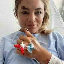 Below Deck Med's Malia White Details "Mean" Scooter Accident