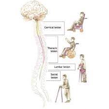 Self Catheter Supplies Spinal Cord Injury Levels Spinal Cord Injury Spinal Cord