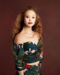 Maybe you would like to learn more about one of these? Fashionforc News Model With Down Syndrome Is An Inspiration To The World