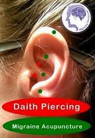 Daith Piercing For Migraines Natural Recipes Daith Piercing Migraine Migraine Piercing Daith Piercing
