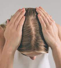 Pcos Hair Loss Causes Signs Treatment Remedies And More