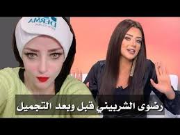 جراحات تجميل الثدي في تركيا تكون السيرة الذاتية لديهم متضمنة خبراتهم، وكذلك نسب نجاح العمليات التي قاموا بإجرائها من قبل. ØªØ­ÙˆÙ„ Ù…Ø°Ù‡Ù„ ÙÙŠ Ø¨Ø´Ø±Ø© Ø±Ø¶ÙˆÙ‰ Ø§Ù„Ø´Ø±Ø¨ÙŠÙ†ÙŠ Ø¨Ø¹Ø¯ Ø¹Ù…Ù„ÙŠØ© Ø§Ù„ØªØ¬Ù…ÙŠÙ„ ÙˆØ§Ù„Ø´Ù‡Ø±Ù‡ Youtube