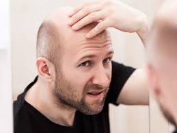 Half finasteride (prescription) is the place to start when it comes to treating hair loss. Hair Loss Treatment Medicines For Hair Fall And Hair Regrowth Times Of India
