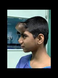 Plastic and Reconstructive Surgery