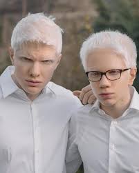 Ladies, apakah anda setuju inilah pria paling tampan di dunia? Bera Ivanishvili Model Albino Paling Ganteng Sejagat Raya