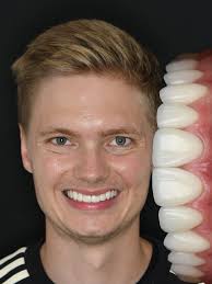 Joseph Stan, DDS (@drjosephstan) • Instagram photos and videos