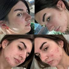 Emily Coloma • EmCo Esthetics