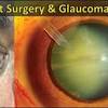Yes, cataract surgery is covered by medicare and commercial insurance as a medically necessary procedure, granted that the patient meets certain criteria. 1