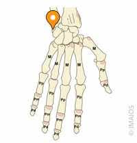 Image result for Pisiform Bone