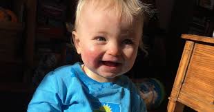 Clubfoot Brace: DTKAFO Journeys: One day at a time