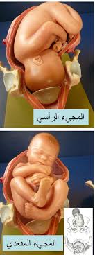 بواسطة الباخرة المنتج طرق الولادة الطبيعية بالصور ffigh org