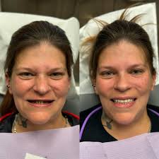 Spent a day in class mastering Invisalign skills with one of the greatest  Invisalign teachers, Dr. Robin Bethell 😁 Holler for a consult!