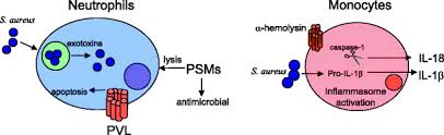 In the 1950s and '60s, the 'phage type 80/81 strain spread widely. Immunopathogenesis Of Staphylococcus Aureus Pulmonary Infection Springerlink