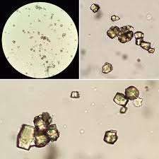 Pin On Nephro Pics