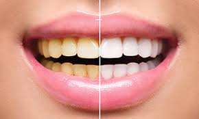Pet dental health is vital in the long term overall health of your pets and when it comes to pet dental disease or injuries, it's important to choose a board certified veterinary dentist who can provide the highest level of care for your pet. Pearl Dental Care Archive Most Recommended Dental Clinic In Dubai