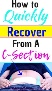 C Section Recovery Tips C Section Recovery Breastfeeding After C Section C Section