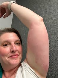 45 days back: I wore a suit and they decided to attack. That's why I  meditated and used a medicinal smoke to calm them while I harvested. 🤣 jk  I did get