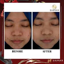 Be the first to answer! Produk Mary Kay Untuk Hilangkan Jeragat