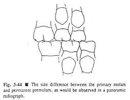 Space Relationships In Replacement Of Canines And Primary