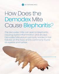 Image result for Demodex folliculorum