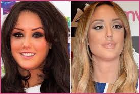Pin On Plastic Surgery