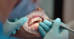 Image result for Gag Reflex