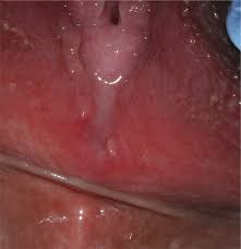 This Photograph Of The Genital Area Of A 12 Year Old Girl Shows A Download Scientific Diagram