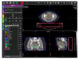 Nickfinder is one of the most popular websites which is used by fire fire players to generate stylish nicknames for their profile. Healthcare Free Full Text Integrated Natural Language Processing And Machine Learning Models For Standardizing Radiotherapy Structure Names