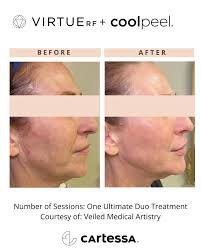 Meet Practice Development Consultant, Marissa Moses! Marissa covers NC, SC,  and AL, and is a true PD rockstar! . . #morethanadistributor  #cartessaaesthetics #cartessadifference #youragentinaesthetics