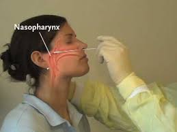 Nejm Procedure Collection Of Nasopharyngeal Specimens With The Swab Technique Youtube