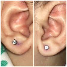 Super Uneven Ear Piercing Babycenter