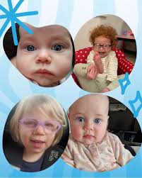 Microphthalmia, Anophthalmia & Coloboma Support