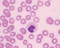 C shows feline blood with the neutrophils having. Systemic Inflammatory Response Syndrome And Sepsis Part 1 Recognition And Diagnosis Today S Veterinary Practice
