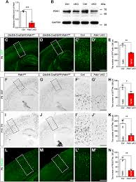 Efforts to redesign education ultimately require rethinking teachers' preparation and professional development. Pdk1 Regulates The Survival Of The Developing Cortical Interneurons Molecular Brain Full Text