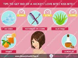 Having to answer questions about how you got a hickey can be very embarrassing. How To Get Rid Of A Hickey Love Bite Kiss Bite