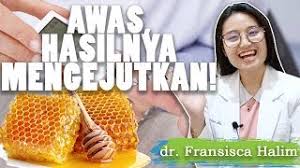 Ia merupakan kompenen aktif dalam herba cina bagi merawat kencing manis selama ribuan tahun. Cara Merawat Luka Diabetes Dengan Madu Krim Luka Kencing Manis Diabetes