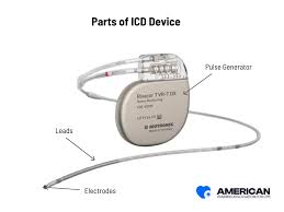 Image result for Internal Cardiac Defibrillator