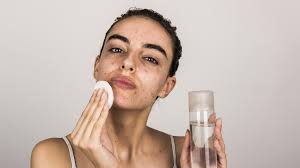 Oily skin can really be a nightmare. A Daily Skincare Routine For Oily Acne Prone Skin Minimalist