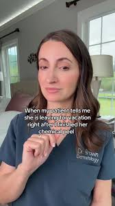 Essential Skincare Tips After a Chemical Peel