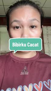 Bibirku Cacat