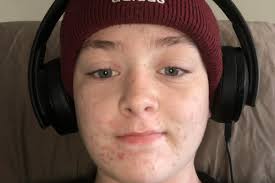 Fundraiser for Benjamin Durand by Madeline Peters : Mason's Nation