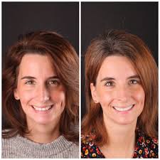 Smile Transformation Austin Artistic Dental ~ The Autism Cafe