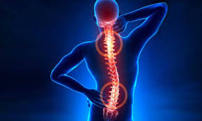 HÉRNIA DE DISCO | Sintomas, causas e tratamento