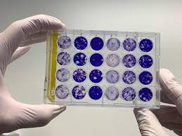 Image result for Neutralization Test