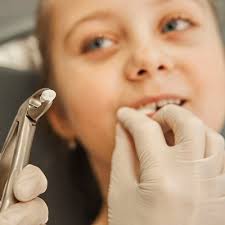 Teeth Extraction Cost In Dubai | Only 1,490 AED