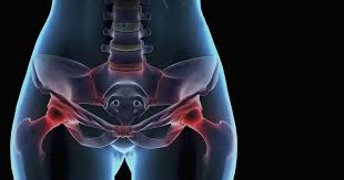 Pelvic bone cancer is a condition in which tumors grow in the pelvis, causing intense pain. Pelvic Pain Symptoms Causes Treatments