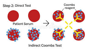 Image result for Direct Coombs