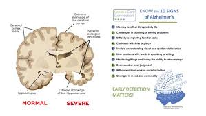 Image result for Behavior Problems in Dementia