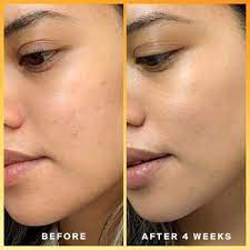 It turns out, the answer is not so simple. Daily Dose Vitamin C Spf 40 Sunscreen Serum Pa Supergoop Sephora